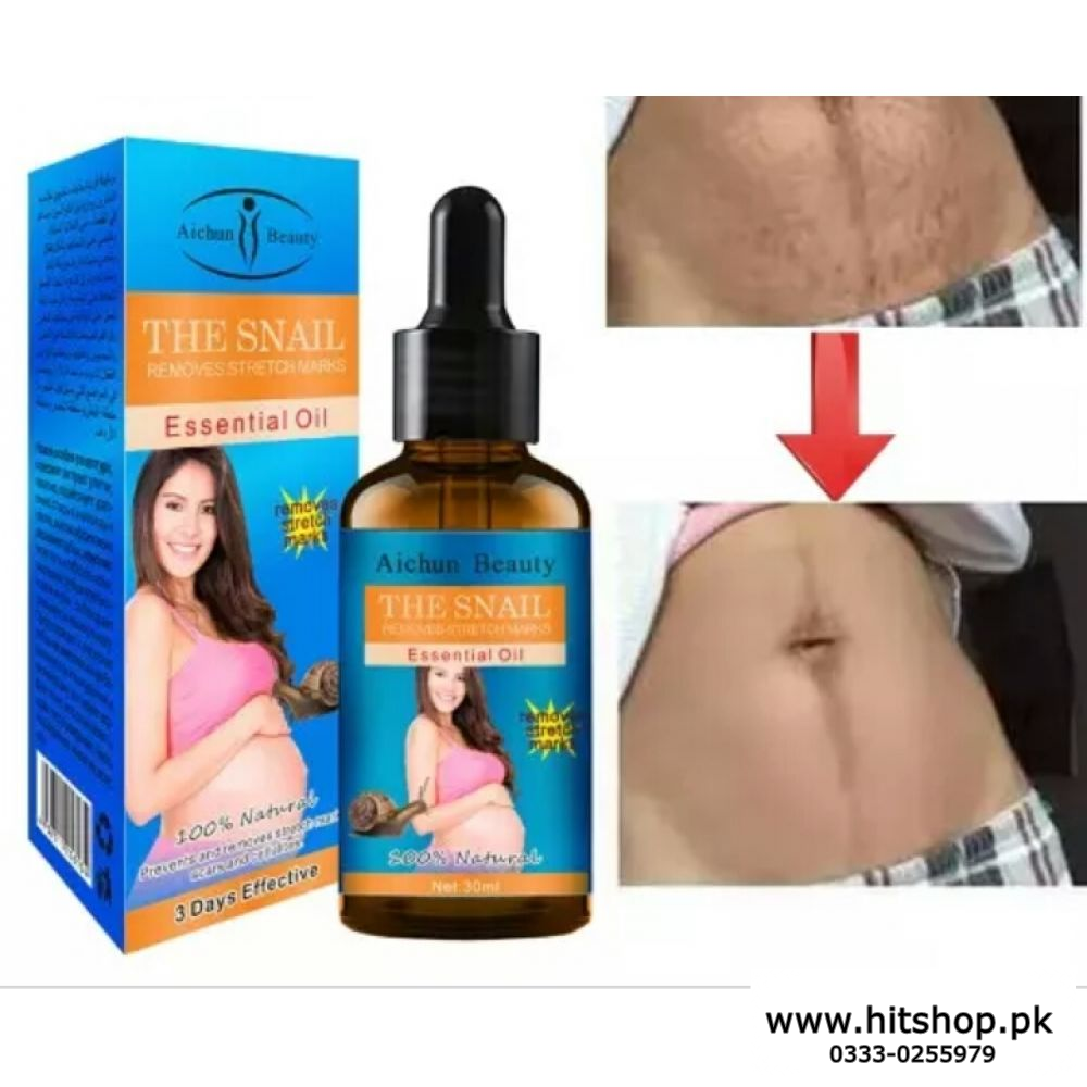 Stretch Marks Remover 